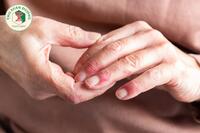 <a href="/benh-pho-bien/benh-ngoai-da" title="Ngoài da" rel="dofollow">Ngoài da</a>