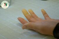 <a href="/benh-kho/xo-cung-bi" title="Xơ cứng bì" rel="dofollow">Xơ cứng bì</a>