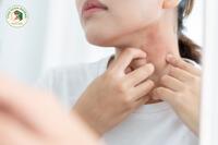<a href="/benh-pho-bien" title="Bệnh phổ biến" rel="dofollow">Bệnh phổ biến</a>