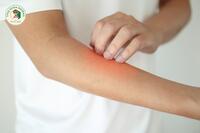 <a href="/benh-pho-bien" title="Bệnh phổ biến" rel="dofollow">Bệnh phổ biến</a>
