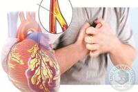 <a href="/benh-pho-bien/tim-mach/benh-mach-vanh" title="Bệnh mạch vành" rel="dofollow">Bệnh mạch vành</a>