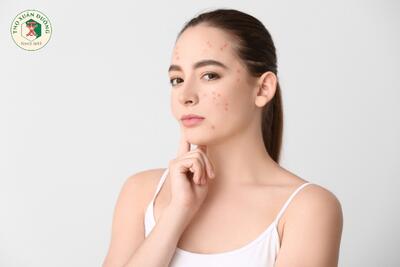 <a href="/benh-pho-bien/benh-ngoai-da" title="Ngoài da" rel="dofollow">Ngoài da</a>