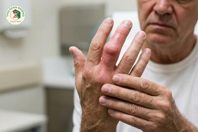 <a href="/benh-pho-bien/xuong-khop" title="Cơ xương khớp" rel="dofollow">Cơ xương khớp</a>