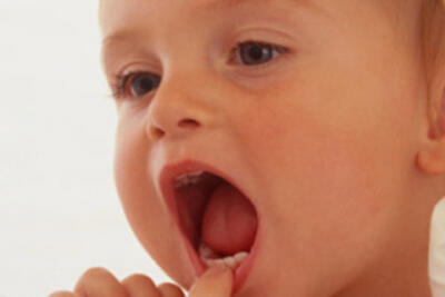 <a href="/kien-thuc-ngay-nay/benh-hoc/rang-ham-mat" title="Răng hàm mặt" rel="dofollow">Răng hàm mặt</a>