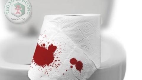 SKCĐ-Đi ngoài ra máu có thể là bệnh gì?