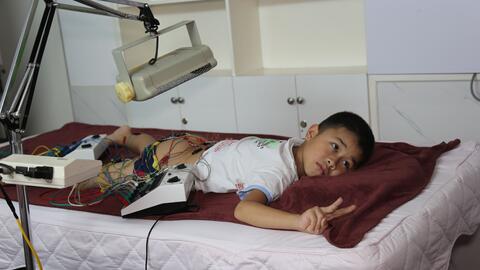 SKCĐ - Thế mạnh của y học cổ truyền trong điều trị loạn dưỡng cơ duchenne