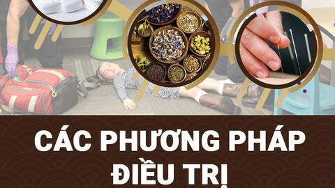 SKCĐ - Bệnh động kinh có chữa khỏi được không?