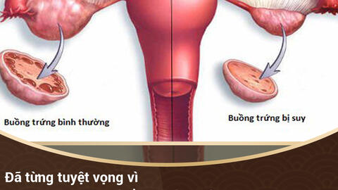 SKCĐ - Khám hiếm muộn, vô sinh ở đâu uy tín?