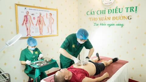 NCT - Ứng dụng cấy chỉ đông y trong giảm béo