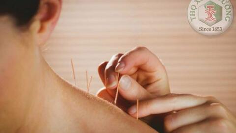 Đông y điều trị đau vai gáy