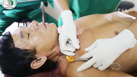 Người bị bệnh xơ cứng bì cần chú ý những điều gì ?