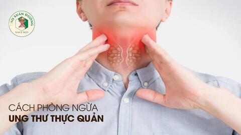 Làm thế nào để phòng ngừa bệnh ung thư thực quản?