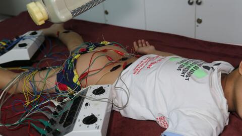 Giải đáp một số thắc mắc về bệnh loạn dưỡng cơ 