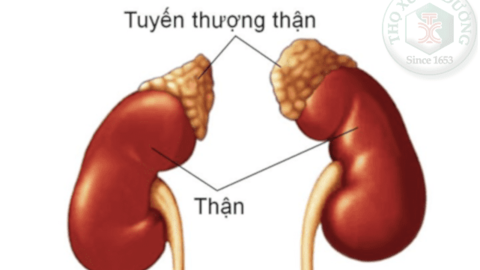 Các loại u tuyến thượng thận thường gặp