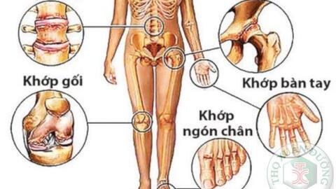 Các thể lâm sàng bệnh viêm cột sống dính khớp