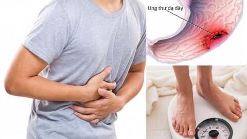 Dấu hiệu cảnh báo sớm và biện pháp phòng tránh bệnh ung thư dạ dày