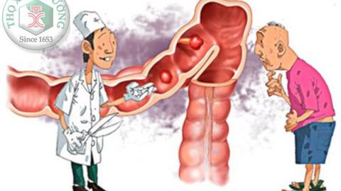 Tìm hiểu nguyên nhân ung thư đại tràng