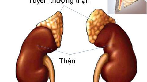 Các phương pháp chẩn đoán ung thư tuyến thượng thận
