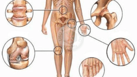 Viêm khớp thiếu niên tự phát
